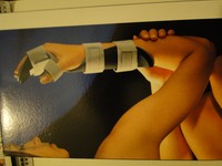 ARCUS Carpalorthese, Neuwertig, rechts, Handgelenkschiene, Handgelenkstütze