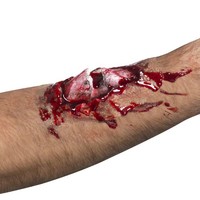 Latexwunde offener Bruch